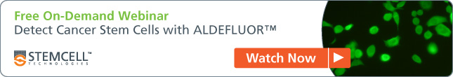 [Free On-Demand Webinar] Detect Cancer Stem Cells with ALDEFLUOR™ Watch Now